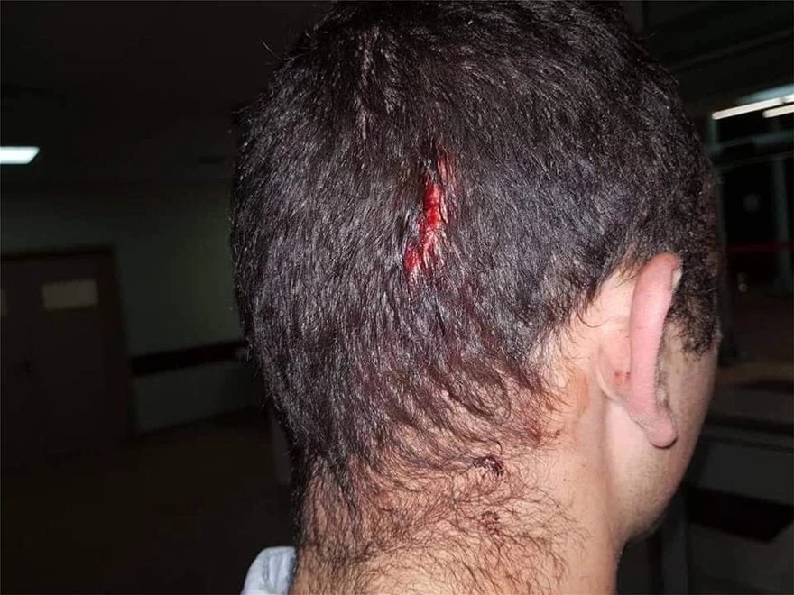 Άνοιξαν κεφάλια αστυνομικών στην Πειραιώς! –  Βεντέτα από Ρομά – Ο δράστης είχε αποφυλακιστεί με τον νόμο Παρασκευόπουλου